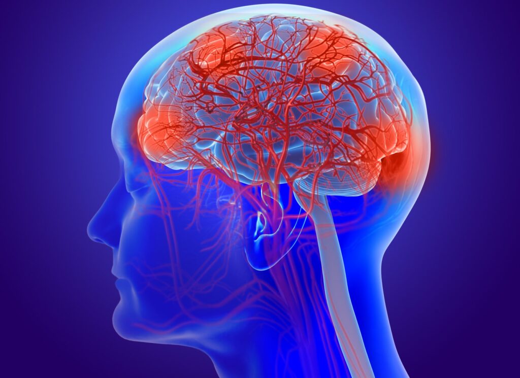 Aging and Alzheimer’s Linked to Changes in Brain’s Microvasculature