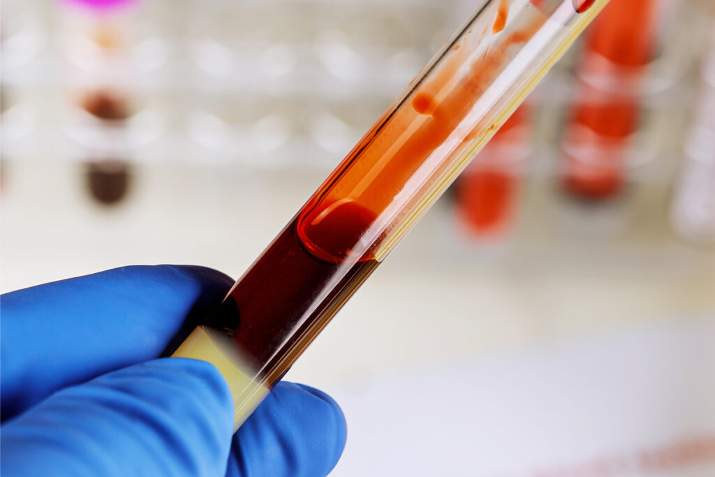 Blood test reads aging organ by organ