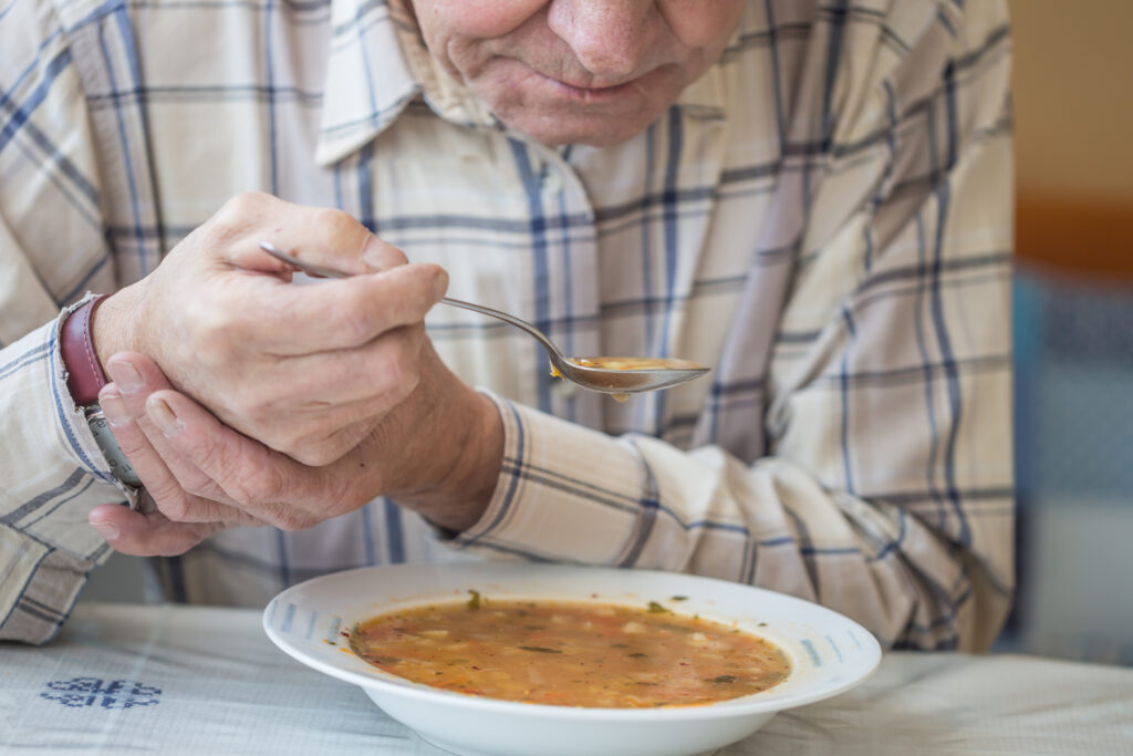 Personalized Neurostimulation Effective for Parkinson's Disease