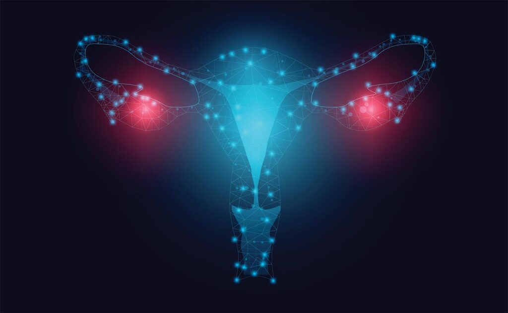 Personalized Ovarian Cancer Test Combines Age and CA125 to Detect Disease Earlier