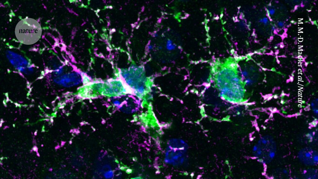 Swapping old immune cells in the brain with fresh ones could treat disease