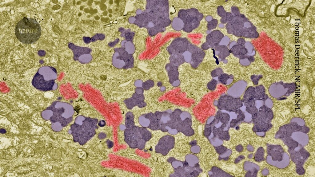 Blood tests are now approved for Alzheimer’s: how accurate are they?