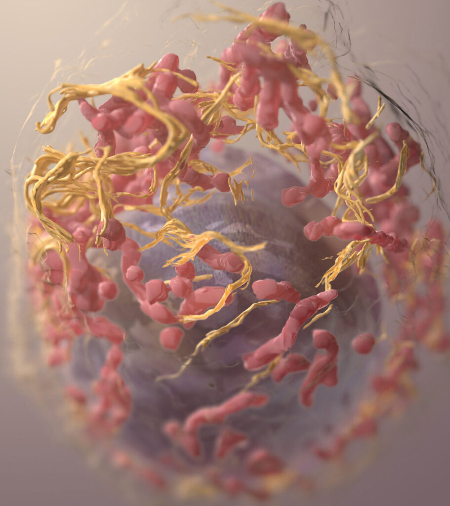 “Craters” on Melanoma Tumors Unveil Biomarker of Immunotherapy Success