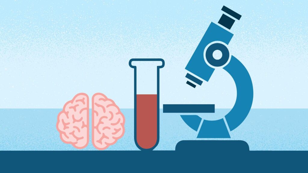 New Blood Test to Rule Out Alzheimer’s Gets FDA Clearance