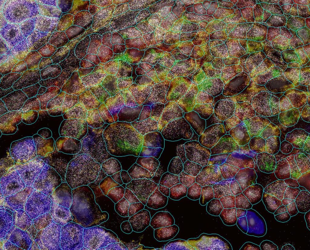 CosMx Subcellular Imaging
