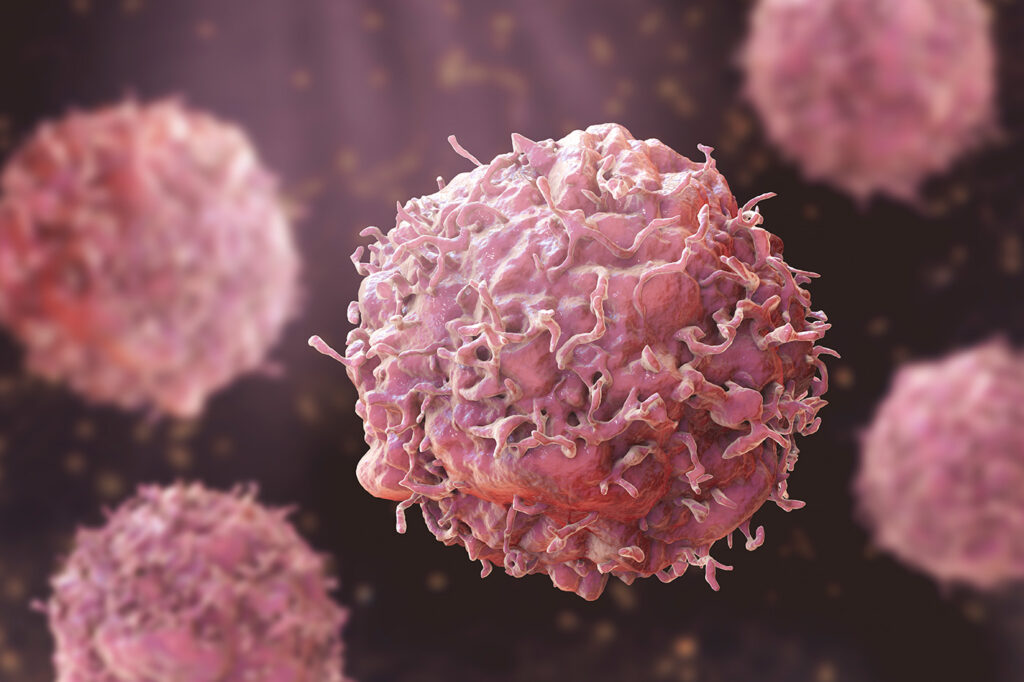 Home Cancer Tests Using Breath and Urine Get U.S. Funding Boost
