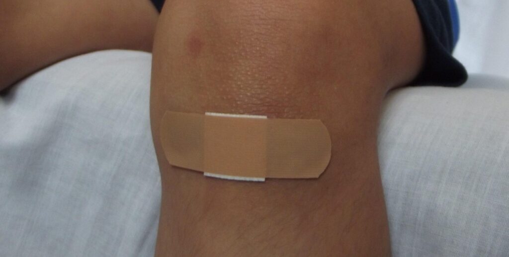Microbiome Modulation: A New Frontier in Wound Management