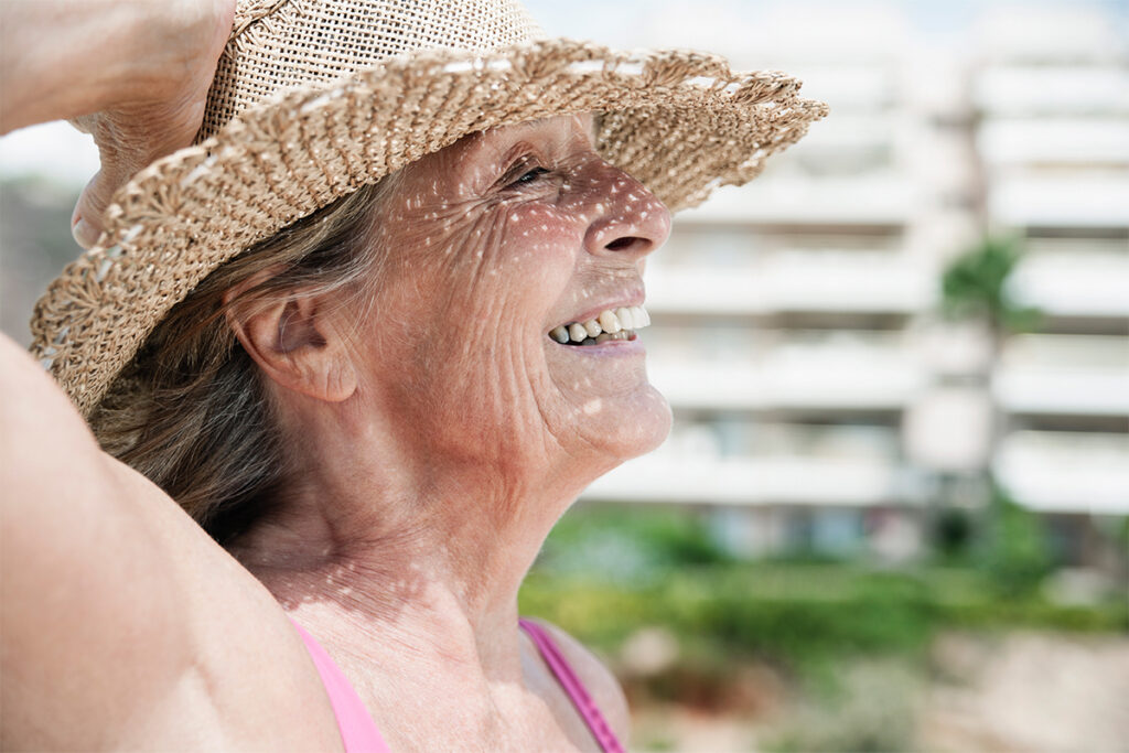 Molecule shows skin longevity potential in sun aging study