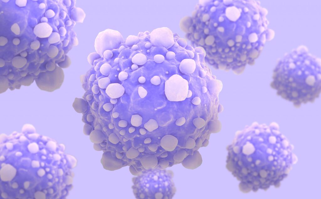 Pancreatic Cancer Cells Rely on Acidic Environment to Survive