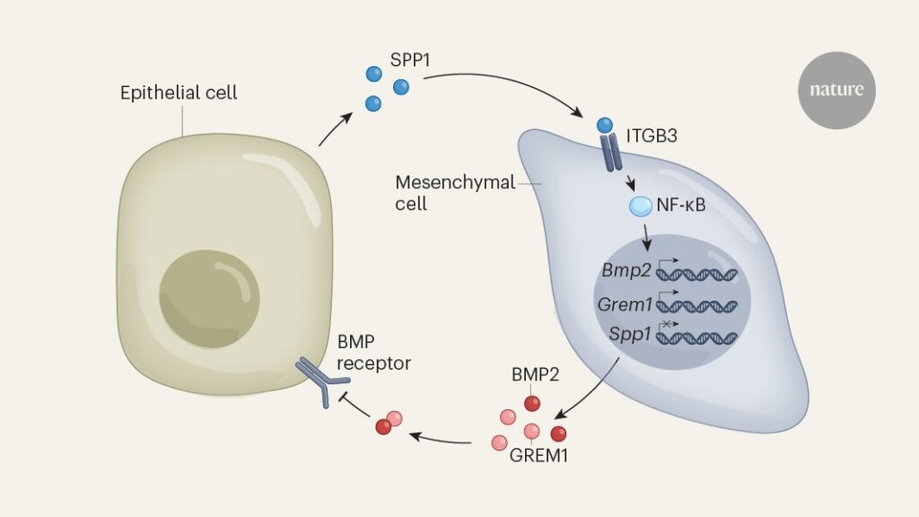 Pancreatic cancer relies on opposing signalling pathways to drive its cellular diversity