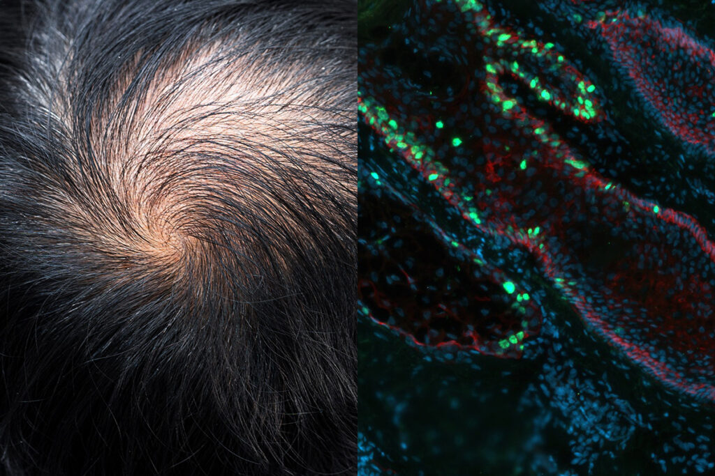 Pelage sweeps up $120m to reverse hair loss - Longevity.Technology