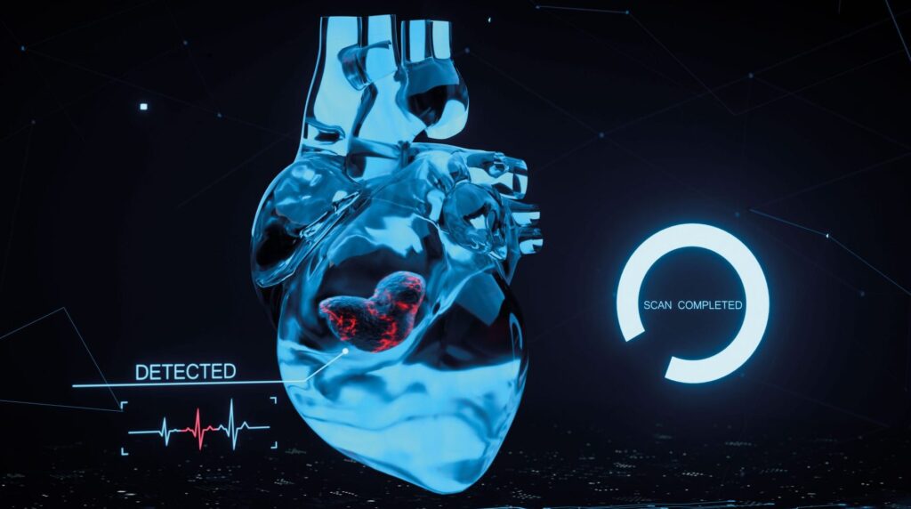 Stem Cell Therapy Lowers Heart Failure Risk After Heart Attack Stem Cell Therapy Lowers Heart Failure Risk After Heart Attack