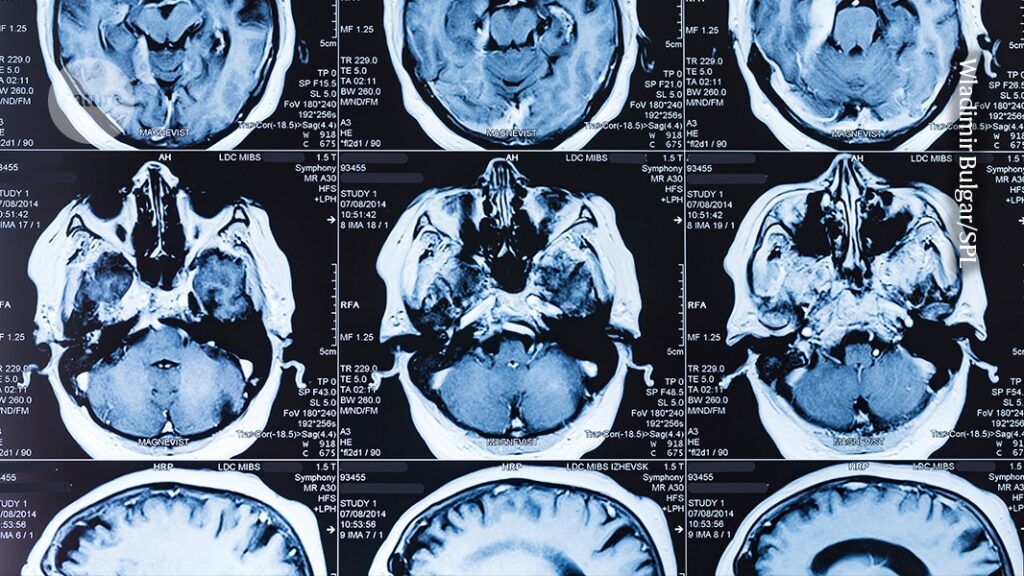 breakthroughs that show why fundamental research must be protected breakthroughs that show why fundamental research must be protected
