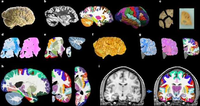 A probabilistic histological atlas of the human brain for MRI segmentation A probabilistic histological atlas of the human brain for MRI segmentation