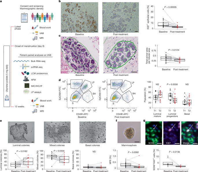 Anti-progestin therapy targets hallmarks of breast cancer risk Anti-progestin therapy targets hallmarks of breast cancer risk