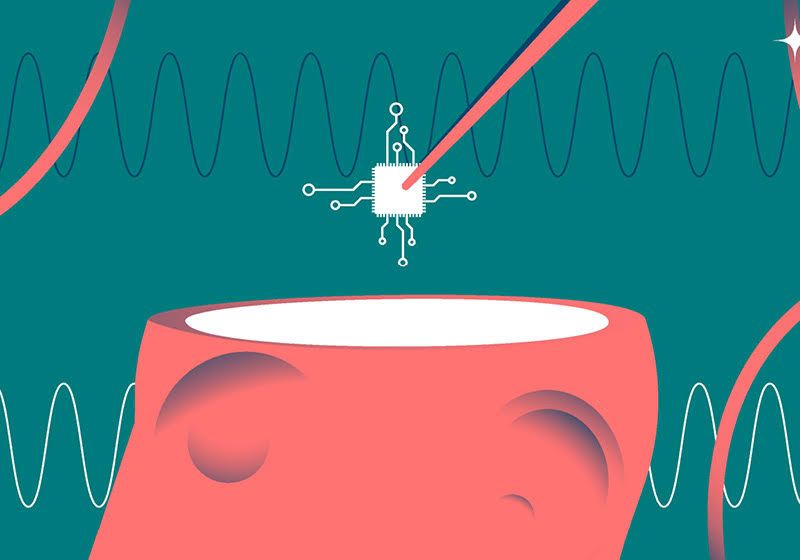 Cell-Electronic Hybrid Chips Could Enable Surgery-Free Brain Implants The Scientist Logo