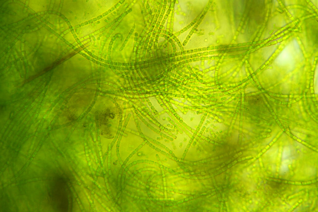 Cyanobacterial Pigments Advance Biomedicine Through Smarter Bioprocessing Cyanobacterial Pigments Advance Biomedicine Through Smarter Bioprocessing