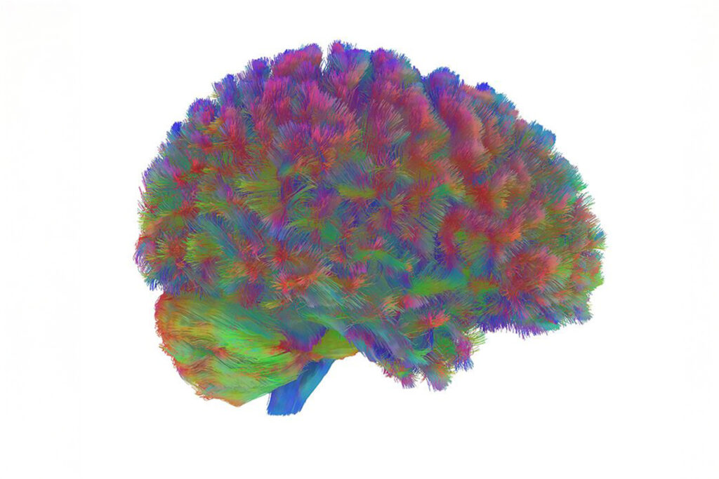 New map reveals five eras of brain aging