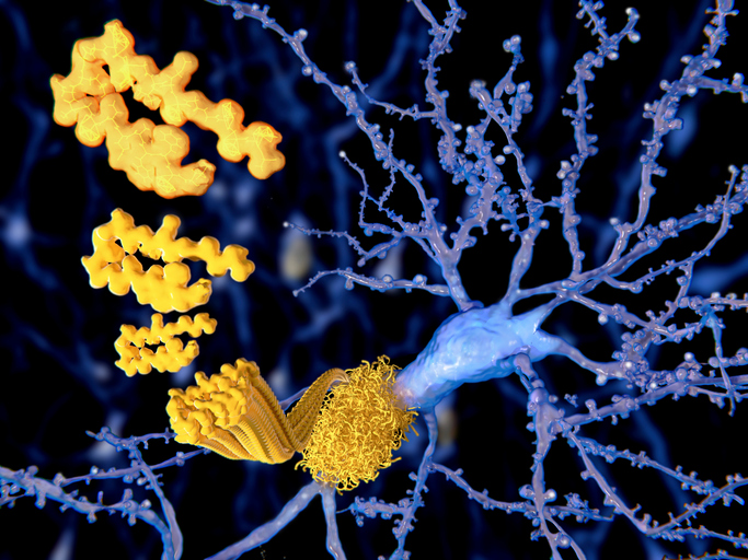 Novo Nordisk’s GLP-1 Drug Fails to Improve Alzheimer’s Symptoms Amyloid beta peptide, illustration