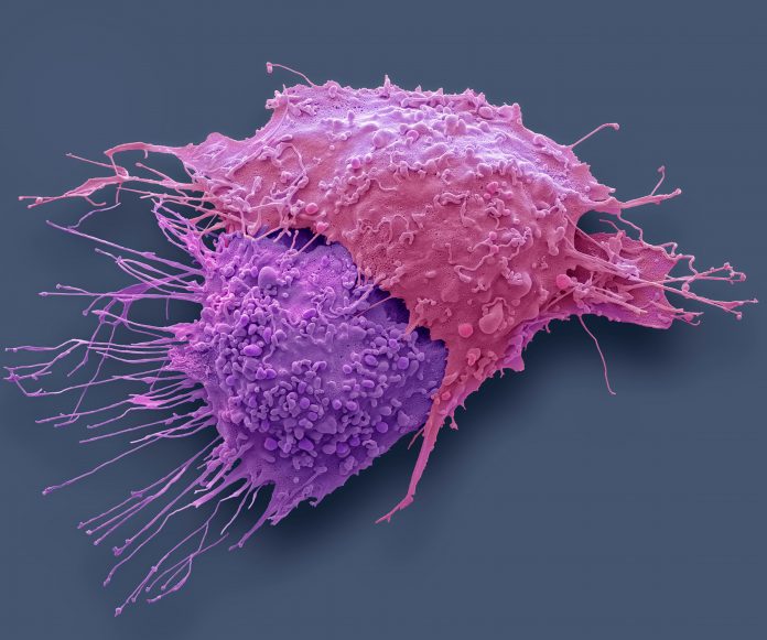 Polymer-Coated Nanoparticles Deliver IL-12 Directly to Ovarian Tumors ovarian cancer cells