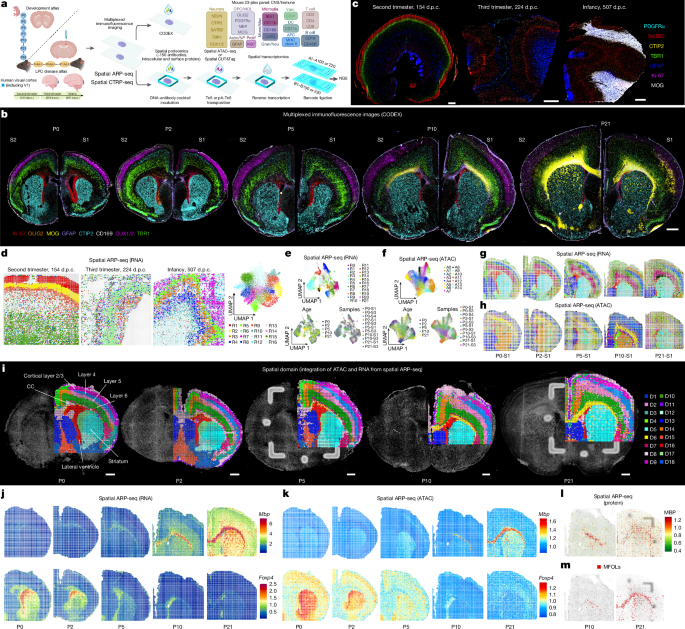 Spatial dynamics of brain development and neuroinflammation Spatial dynamics of brain development and neuroinflammation