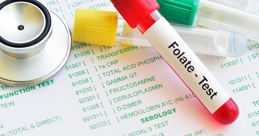 Study finds Optifolin+ absorbs faster than standard folic acid