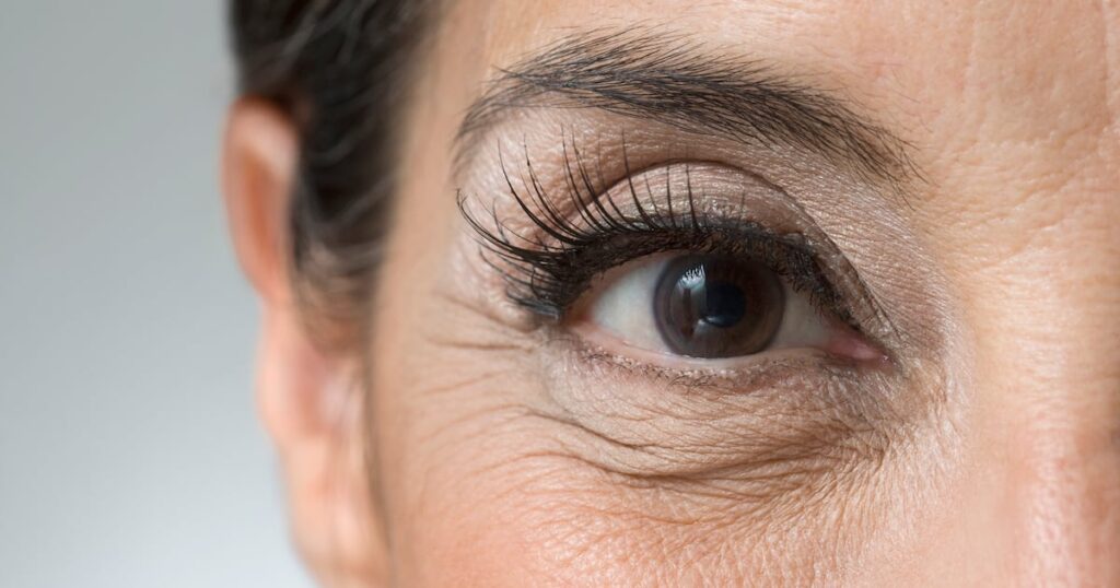 Study finds oral supplement can reduce wrinkles in 12 weeks Study finds oral supplement can reduce wrinkles in 12 weeks