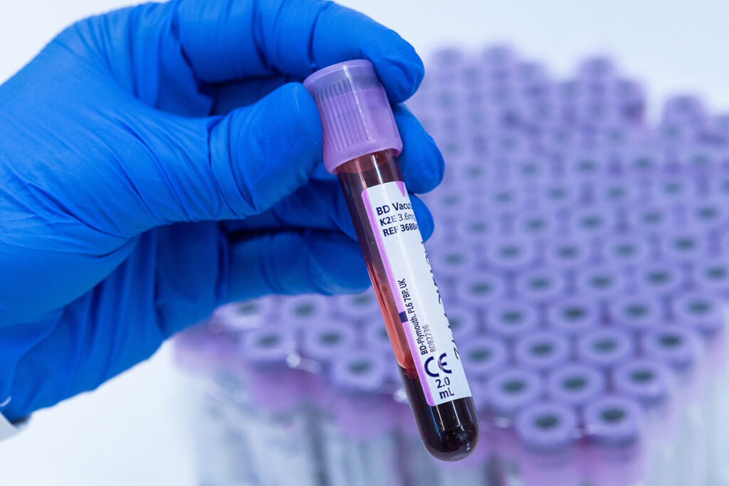 $30k NADMED award to advance metabolomics research