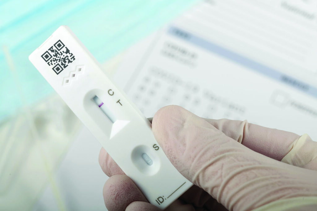 Antibody Impact on Lateral Flow Assay Performance