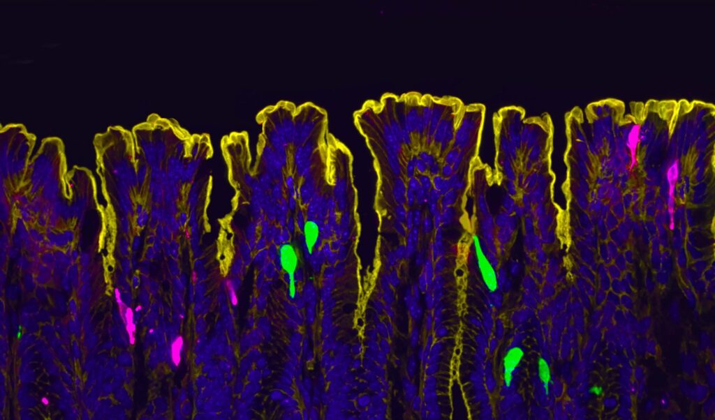 Cells lining the mouse colon.