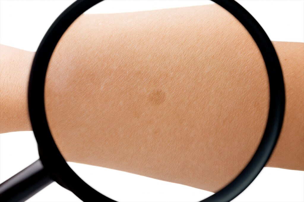 Hidden blood molecules hint at new paths to skin-aging therapies