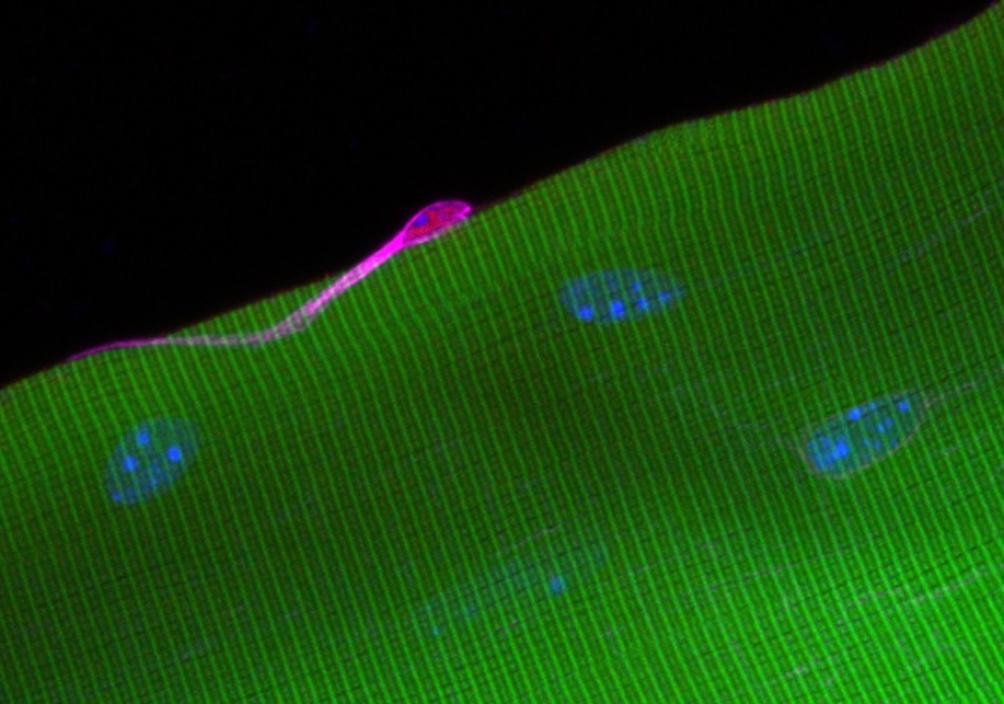 Muscle Stem Cells Bolstered by ECM Protein Tenascin-C Muscle stem cell on myofiber.
