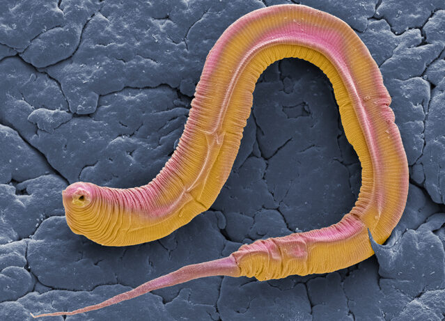 Plant Hormone Controls Protein Levels in Living Worm, Improves Aging Model Plant Hormone Controls Protein Levels in Living Worm, Improves Aging Model