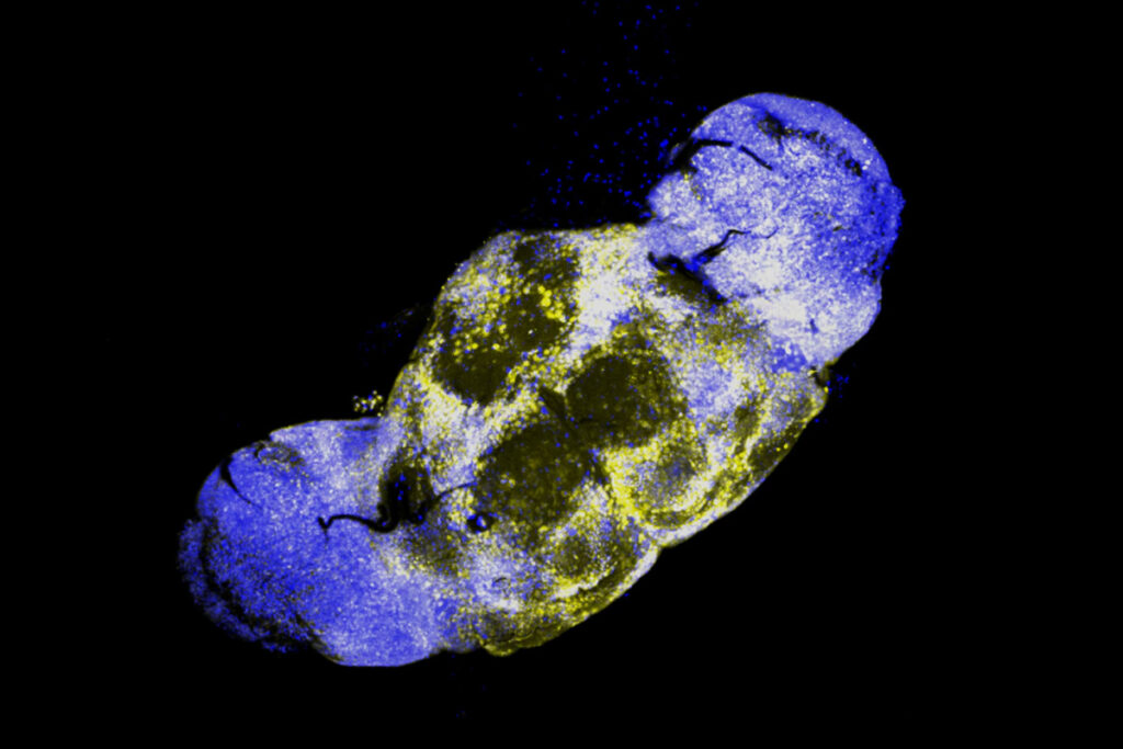 Amyloid’s 'memory mode' comes with a chaperone