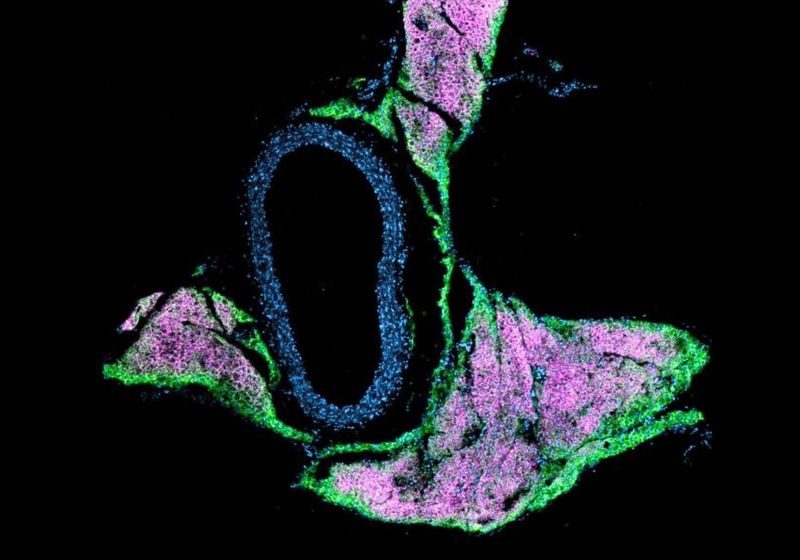 How Fat Type Shapes Hypertension Risk The Scientist Logo