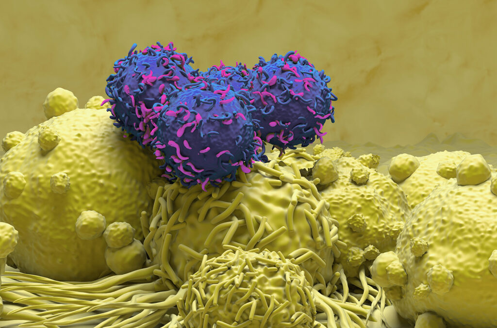 Macrophage-Targeting CAR T Cell Therapy Improves Survival in Solid Tumor Mouse Models CAR-T cell therapy for kidney cancer