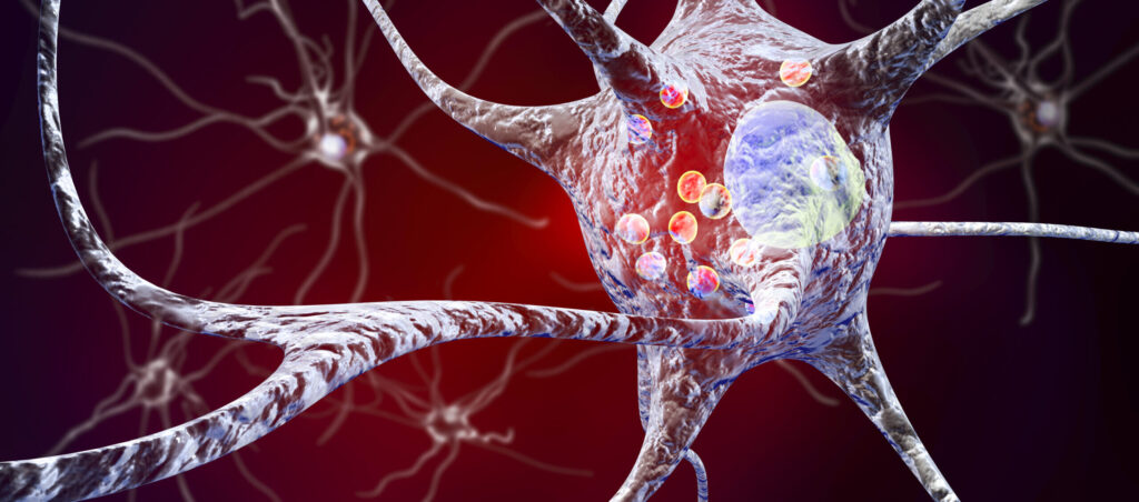Nautilus, Weill Cornell Team Up to Apply Single Molecule Proteomics Tech to Parkinson’s
