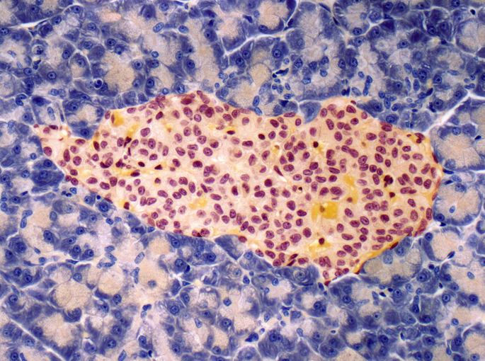 Electronic Mesh Spurs Islet Cell Maturation, Could Aid Diabetes Care Islet of Langerhans, light micrograph