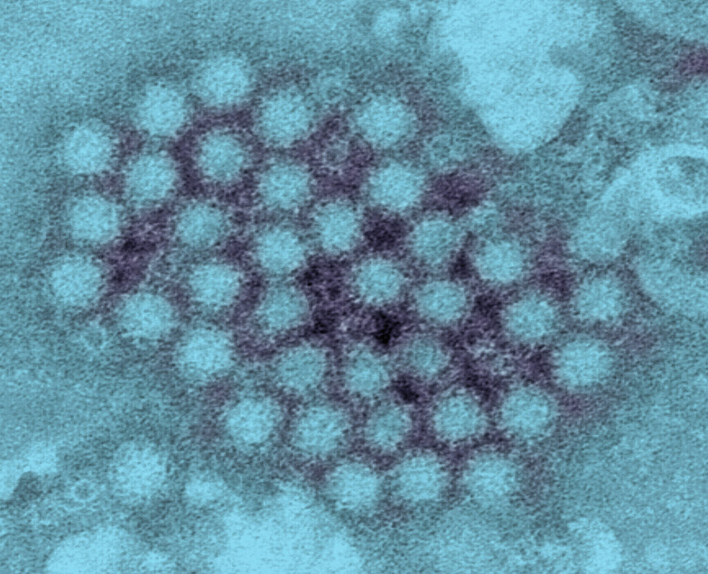 TEM of norovirus virons