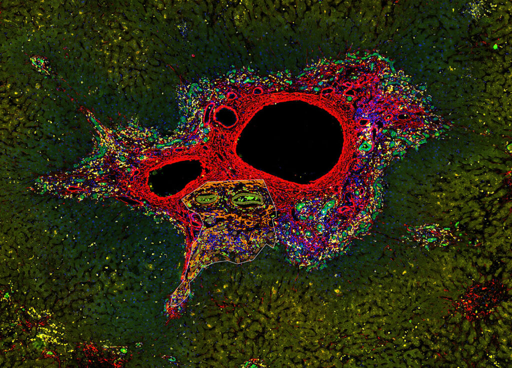 The Coming of Age of Spatial Multiomics The Coming of Age of Spatial Multiomics