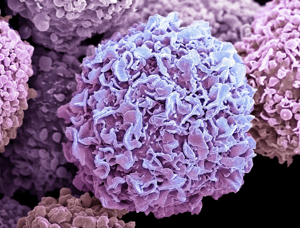 Triple Negative Breast Cancer Cells Use ‘Sticky Coat’ to Support Clustering, Metastasis