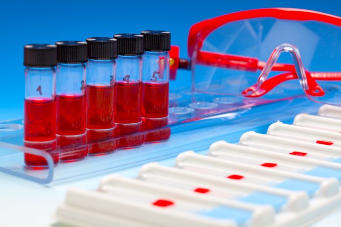 Blood-Based ctDNA Test May Guide Breast Cancer Care in Older Women Liquid Biopsy Oncology Diagnostic