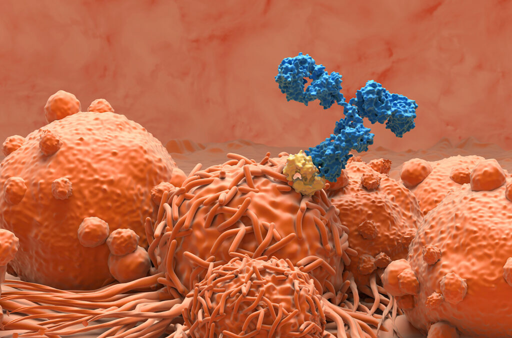 Monoclonal antibody therapy for kidney cancer