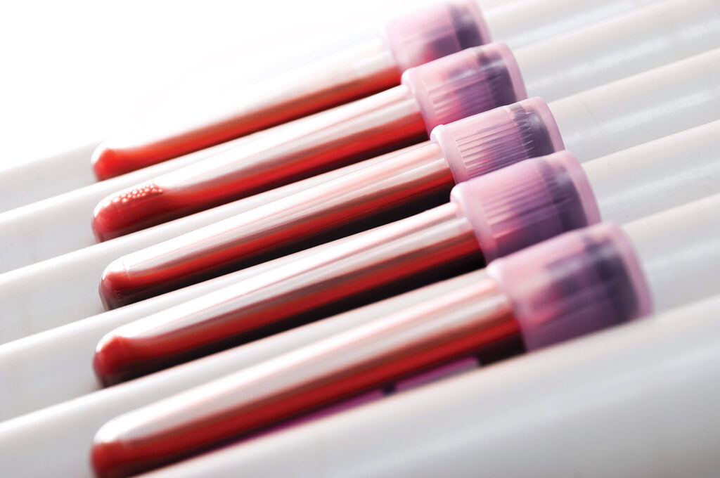 DNA Fragments Flag Multiple Diseases in Blood