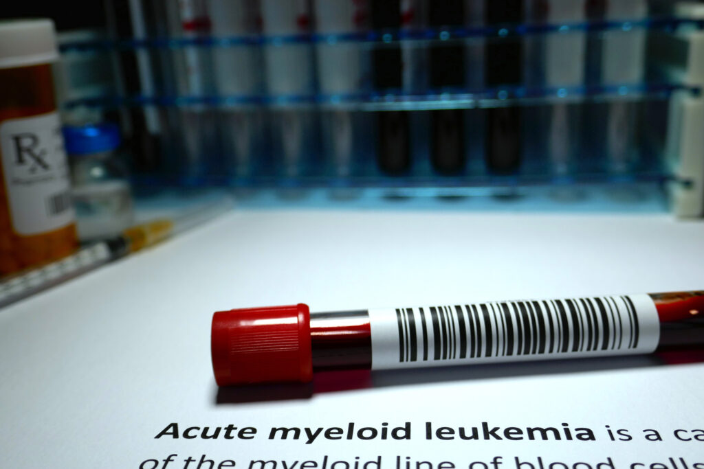 Genomic Tool Bridges Diagnostic Leukemia Gaps