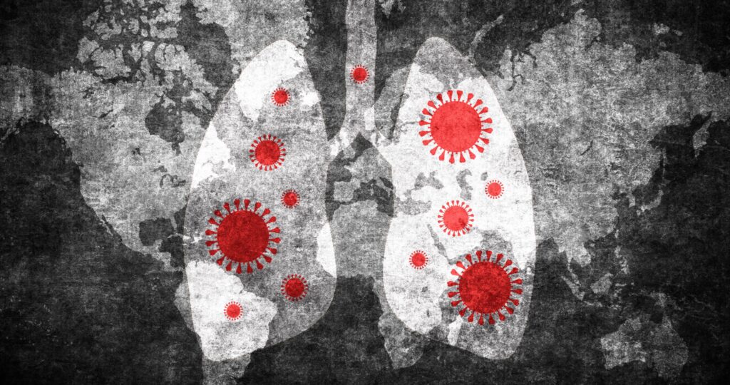 Severe COVID-19 Infections May Prime the Lung for Cancer Growth
